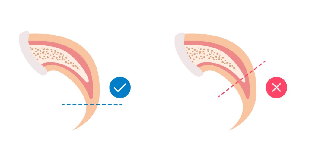 How to trim cat nails safely infographic - cutting line